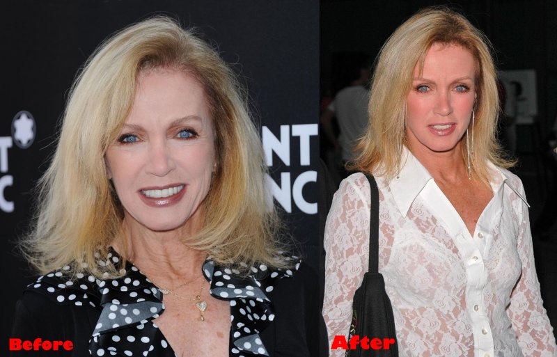 Donna mills